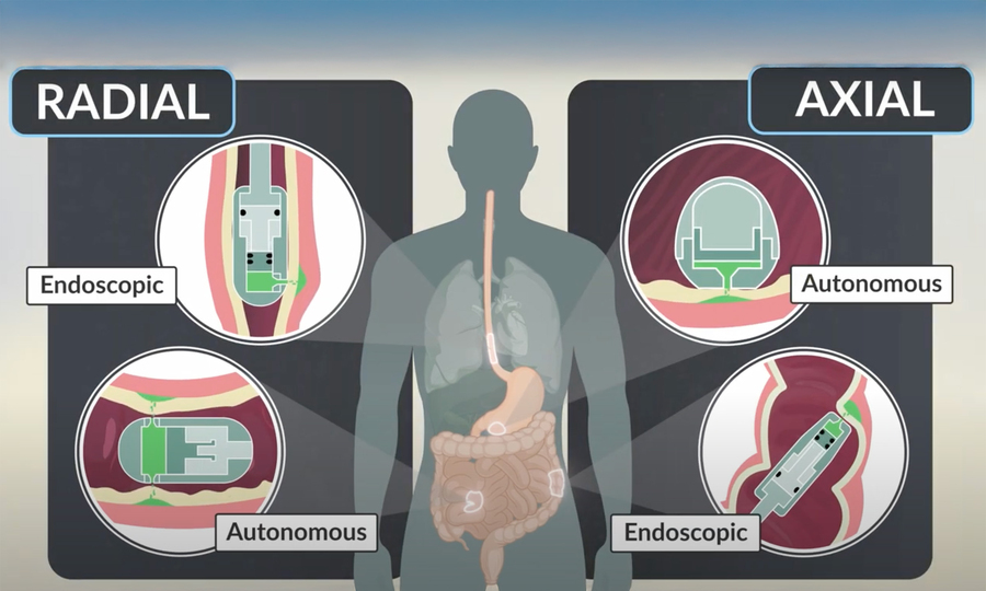 Various microjet devices showing radial and axial delivery methods for both endoscopic and autonomous devices.