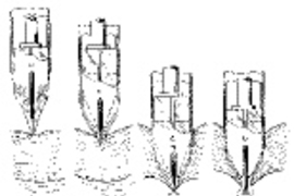 This diagram from Professor Blanco's trocar patent application shows the progression of his trocar as it pierces the skin during endoscopic surgery. At the moment the sharp point perforates through the skin (third image), the safety guard has already fully deployed, protecting internal organs. A puff of CO2 further safeguards the organs by gently blowing them out of reach.