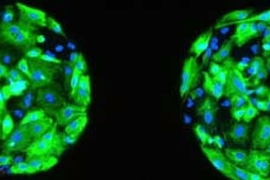 Human embryonic stem cells were coaxed to differentiate into epithelial (skin) cells atop the two spots of biomaterial shown here. Cytokeratin (a marker of epithelial cells) is stained green; cell nuclei are blue.