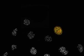 Cells that have damaged DNA in their nuclei (gray dots) normally stop dividing. However, the two cells for which MAPKAP Kinase-2 activity has been inhibited still undergo cell division (red stain), even in the presence of DNA damage (green stain).