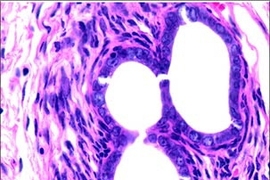 In these endometriosis lesions from the mouse model of endometriosis, both endometriotic glands (arrow) and stroma (arrowhead) are shown.