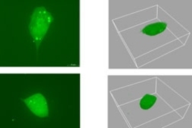 Researchers tracked the movement of human prostate tumor cells, such as the one at left, in a 3-D matrix, right.