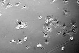 MIT researchers have discovered that treating bone marrow stem cells with a growth factor called EGF promotes their survival and growth when the EGF is tethered to a scaffold. This image shows stem cells with no EGF treatment. <a onclick="MM_openBrWindow('stem-cells-1-enlarged.html','','width=509, height=583')">
<span onmouseover="this.className='cursorChange';">Open image gallery</span>
</a>
<...