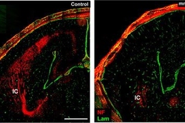 This image of axons in a mouse embryo was taken after 16.5 days of gestation. In a normal mouse, left, axons (red) extend from the cortex upwards towards a part of the brain known as the internal capsule. In a mouse lacking Ena/VASP proteins, the axons fail to grow.