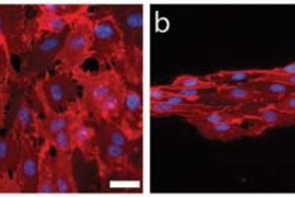 When endothelial progenitor cells are grown on a nanopatterned substrate, they align in the direction of the pattern (right). At left are cells grown on a flat surface.