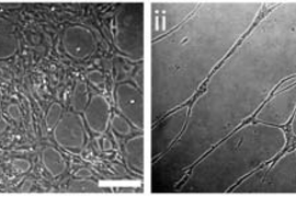 When a gel that induces tube formation is added to the cells, the cells grown on a nanopatterned surface form tubes aligned in the same direction (right). Cells grown on a flat surface form tubes extending in many directions (left).