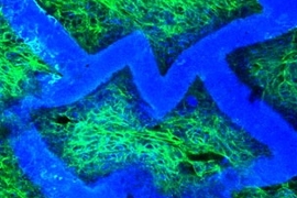 Confocal micrograph of an accordion-like honeycomb scaffold with cultured rat heart cells (scaffold is colored blue; seeded, living heart cells are colored green with blue nuclei). Original magnification = 250X.