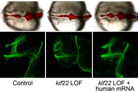 Zebrafish with certain genes turned off during embryonic development (center and right images) showed abnormalities of brain formation (top row) and axon wiring (bottom row). At left is a normally developing zebrafish embryo.