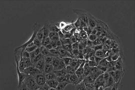 A microscopic image of cancer cells adhering to a spot coated with molecules found in the extracellular matrix. 