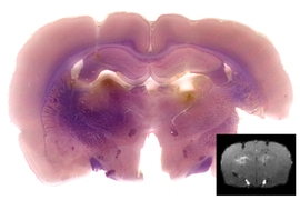 MIT researchers used a novel MRI contrast agent to track the location of a reporter protein called SEAP, indicated by the bright spot on the left side (inset). The larger image shows the corresponding optical image of the same contrast agent.