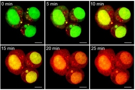 The particles were designed to release doxorubicin when exposed to ultraviolet light. Here, ovarian cancer cells turn red as the doxorubicin is released over time. 