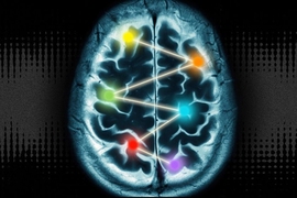 Illustrated brain with colored lights inside