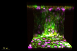 This image shows endothelial cells lining the 2-D media channel, forming a wall of cells along a vertical surface of collagen. Endothelial cell nuclei are shown in purple; vascular-endothelial cadherin, which are involved in cell-to-cell adhesion, are in green.