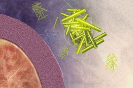 MIT biologists found that the yeast protein Rim4 forms disordered clumps similar to the beta-amyloid plaques associated with Alzheimer’s disease, shown here.