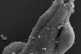 A cancer cell (bottom center) creates a gap and enters the endothelial tube. Another cancer cell (middle right) sends out nanotubes to connect with endothelial cells.