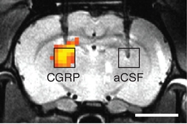 MIT researchers have designed protein-based sensors that can dilate blood vessels in the brain. This dilation can be imaged with magnetic resonance imaging (MRI), as seen on the left side of this scan. 
