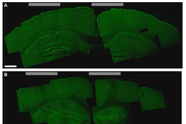 A brain slice that shows the hippocampus cells that were activated by the new stimulation technique (bottom image, lighter green areas on the left)