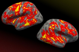 Brain regions that grew significantly thicker in reading-disabled children whose reading improved after an intensive summer treatment program, as shown in the red and yellow areas. Neither a control group nor children who did not respond to treatment exhibited changes in brain structure.”
