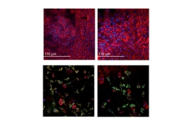 Top left, healthy intestinal cells grown in a microphysiological system (MPS). Top right, ulcerative colitis cells in an MPS. The bottom row shows immune cells, including macrophages, that were added to the tissues.