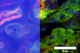 temporal focusing microscopy