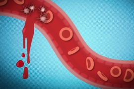 damaged blood vessel graphic