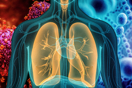 chest x ray graphic with pneumonia virus in background