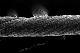 A SEM image shows an extreme closeup of the suture, which has a rope-like texture.