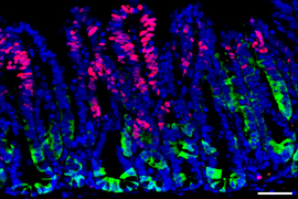 On dark background is a snake-like shape of colorful tumor cells, mainly in blue. Near top are pinkish-red cells, and near bottom are lime-green cells.