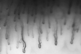 Microscopic image of capillaries
