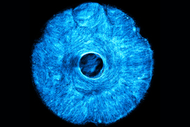 A cyan-colored circular image, full of scratchy lines, resembles an iris.